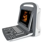 CHISON ECO 2 – Image 2